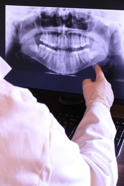 Best Emergency Treatment for Oral Infections in Pueblo West, CO