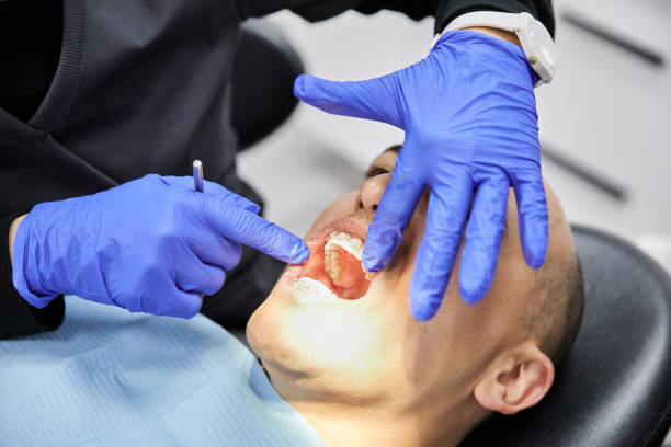 Best Broken or Chipped Tooth Repair in Pueblo West, CO